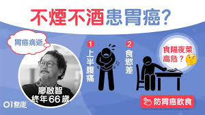 Manage your video collection and share your thoughts. å»–å•Ÿæ™ºé€ä¸– ä¸ç…™ä¸é…'æ‚£èƒƒç™Œ13å€‹åˆæœŸç—‡ç‹€è…¹ç—›åžåš¥é›£é£Ÿå°'å°'å°±é£½ é¦™æ¸¯01 å¥åº·