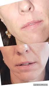 LAB Allure Aesthetics