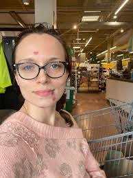 HELPP!!! I am 13 weeks pregnant and before I was pregnant this was my skin  I've tried everything for the redness around my nose it's dry and bumpy