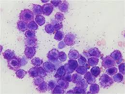 Islet cell tumor, pancreas (m8150/0) d13.7 2a isoimmunization nec. Canine Mast Cell Tumours