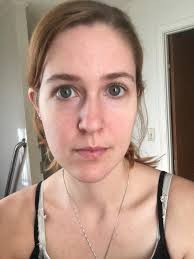 Can I see before and after pictures using the tinted Sun Shield as  foundation?