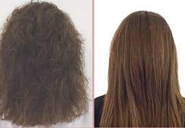 Laser clinics new zealand offers the most affordable prices for laser hair removal, cosmetic injections and skin treatments. Pure Hair And Body Grabone Nz