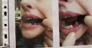 She does not appear to be troubled that her image is being taken and with the skull cap, protecting the winter seems an easy thing. Les Mis Makeup Artist Reveals How She Transformed Anne Hathaway Into A Diseased Prostitute Business Insider