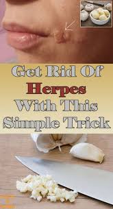 Pin On Natural Healthy Solutions