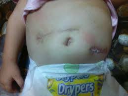 3x makan dan 2x cemilannya di hari pertamanya. Akibat Nestum Usus Bayi Ini Jatuh