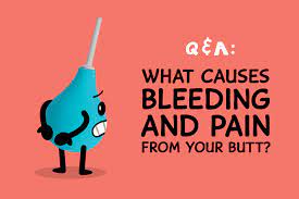 Q&A: What causes bleeding & pain from your butt? - San Francisco AIDS  Foundation