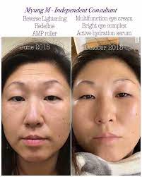 What S Your Main Skin Concern Uneven Skin Tone Sensitivity And Redness Acne Wrinkles Large Pores Looking Skin Care Solutions Skin Care Premium Skincare