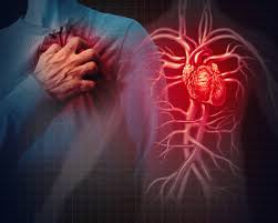 Cardiovascular disease its Symptoms, Risk Factors and Treatment | Sprint  Medical