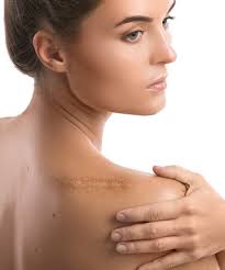 Correct surgical technique can reduce, but not expected results. Scar Treatment Cost In Chandigarh Punjab Scar Removal Clinic In India