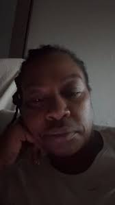 i know the pictures seem lite but this baby is literally three sizes  different from my other finger! going to the dr wednesday if it doesn’t go  down!