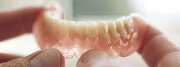 Interimsprothese Die Optimale Zwischenlosung Dentolo
