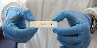 La Complicata Questione Dei Test Sierologici Il Post