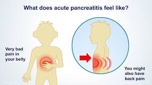 Pin On Animated Pancreas Patient