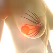 Mastitis Naturlich Behandeln Schwangerschaft Net