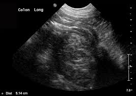 Signs and symptoms symptoms of stomach cancer in dogs usually develop gradually over weeks or months, with vomiting being the most common. Ultrasonography Of The Gastrointestinal Tract Ileum Cecum Colon Today S Veterinary Practice