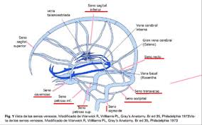 Maybe you would like to learn more about one of these? Trombosis De Seno Venoso Actualizacion Academia Emergencias