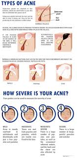 knowing the type and severity of your acne presently and in