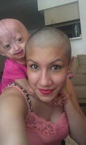 Adalia Rose Age Wiki Died Bio Baby Height Net Worth