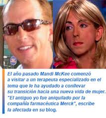 Quiso frenar la calvicie y se convirtió en mujer