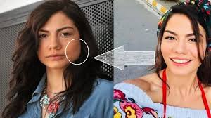 Bir ablası ve bir abisi vardır. Demet Ozdemir Did He Have Plastic Surgery Is The News Of Aesthetic Operation Real Youtube