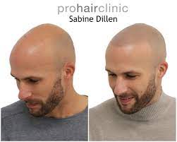 We respond and act quickly. Images Smp Prohair Clinic