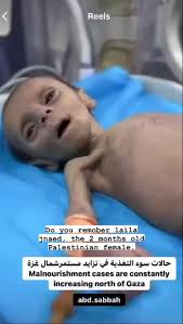 Do you remober laila jnaed, the 2 months old baby girl, she suffer fro...