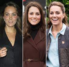 After passing his a levels, prince william took a gap year. Kate Middleton Transformation See The Royal Then And Now Photos