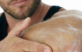 15 Cara Menghilangkan Stretch Mark Secara Alami Tokopedia Blog