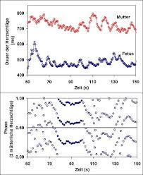 Sieht man da das herz schon schlagen? Babys Herzschlag In Hoherer Mathematik Neue Methode Identifziert Synchronizitat Bei Mutter Und Kind Scinexx De