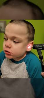 Gavin's Journey With MPS II