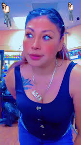 Y Tambien Me Duele La Rodilla