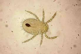 Image result for Trombicula autumnalis