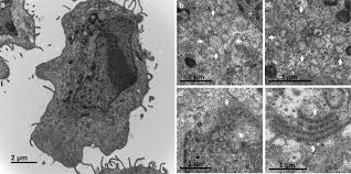 All cells except bacterial cells have a distinct nucleus that contains the cell's dna as well as other structures like mitochondria and the endoplasmic reticulum. Ultrastructural Modifications Induced By Sars Cov 2 In Vero Cells A Kinetic Analysis Of Viral Factory Formation Viral Particle Morphogenesis And Virion Release Springerlink