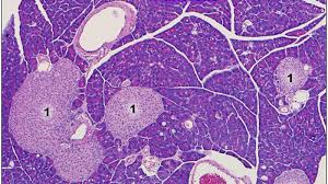 Pancreatic islets contain alpha cells , beta cells , and delta cells , each of which releases a different hormone. Under The Microscope Type 1 Diabetes Johns Hopkins Pathology