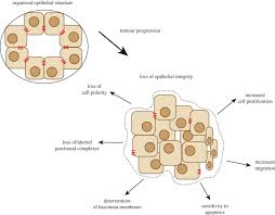 Loss Of Epithelial Integrity Basement Membrane Science Biology Cancer