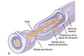 Prevalencia global de la esclerosis múltiple fuente: Fisiopatologia De La Esclerosis Multiple Que Sucede Cuando Se Une El Sistema Nervioso Central Y El Sistema Inmunologico