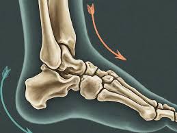 Image result for Talus Fracture