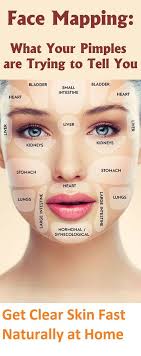 Maybe you would like to learn more about one of these? How To Remove Pimple Marks Fast From Face In One Day Naturally Overnight A Check More At Http Www Clear Skin Fast Face Mapping How To Remove Pimples