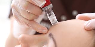 Image result for how much is rf treatment