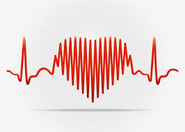 Tachycardia Causes Symptoms And Treatments