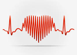 Tachycardia Causes Symptoms And Treatments