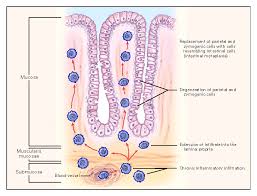 Image result for Anemia angolensis
