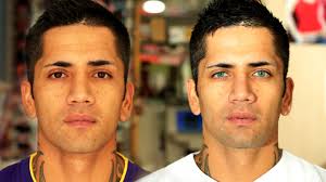 Sea Green Henrea Before And After Its Surgery People Change Your Eye Color Eye Color Change Eye Color Changer