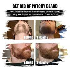 Massage your face using warm water regularly as this will help with the circulation of blood to hair follicles and stimulate fast hair growth. Buy Beard Growth Oil 2 Pack Beard Growth Kit With Castor Oil Serum Conditioner For Men Beard Growth Stimulate Patchy Beard Beard Mustache Facial Hair Growth Promote A Fuller Thicker Stronger Beard Online