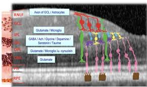 Cant decrease in amyloid plaque size and. International Conference On Alzheimer S And Parkinson S Diseases 2019 Alzforum