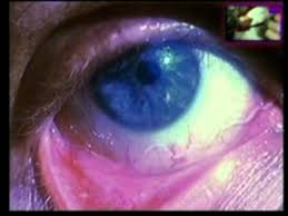 Gozdeki Parazit Youtube