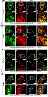 Grants pass, oregon car rental deals found on momondo. Ijms Free Full Text The Artemisinin Derived Autofluorescent Compound Bg95 Exerts Strong Anticytomegaloviral Activity Based On A Mitochondrial Targeting Mechanism Html