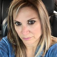 Adopted pitbull with special needs and medical history