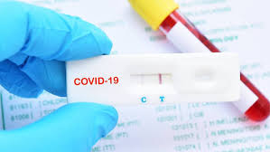Prueba pcr, serología y test antígeno. Dos Test Rapidos Certificados Por El Isp Han Levantado Dudas En El Extranjero