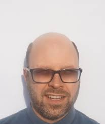 Hair4all Client Before